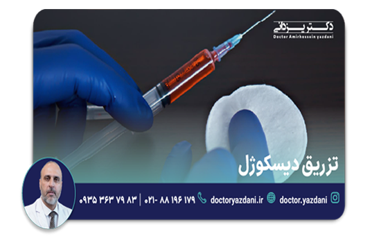 هزینه تزریق دیسکوژل